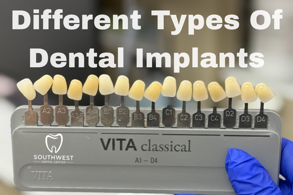 Different types of dental implants